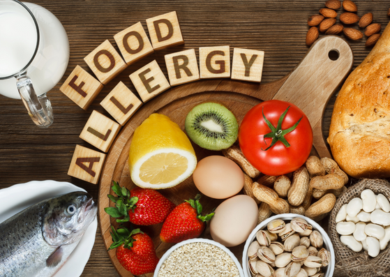 Food Allergy Awareness for Employees cover image